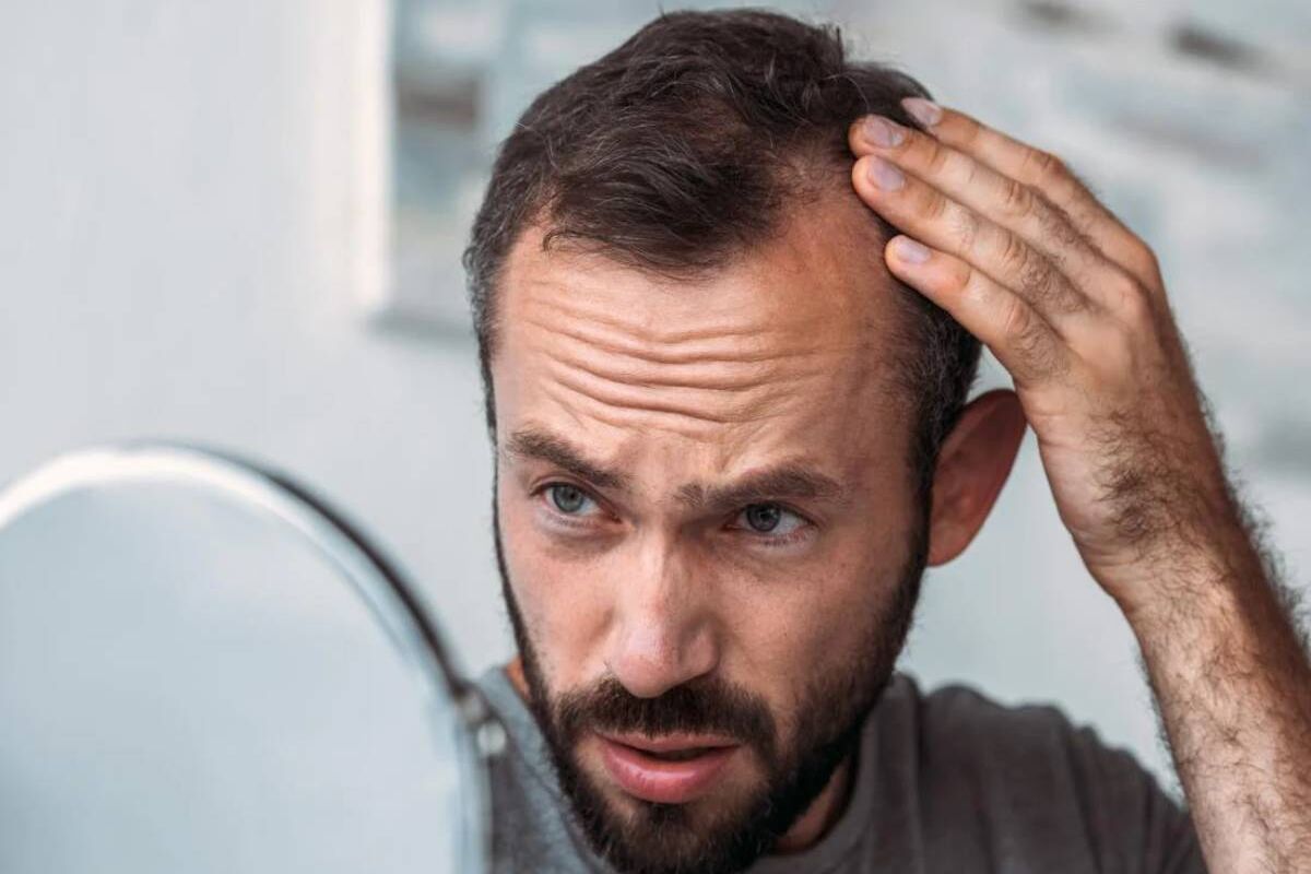 ریزش چند تار مو در روز طبیعی است؟ | روش ساده برای پرپشت شدن موی سر