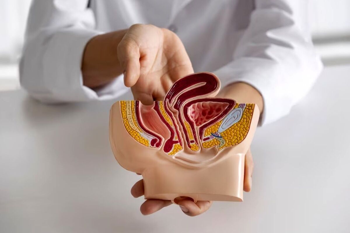 دلیل ابتلا به سرطان روده | این نکات ساده را جدی بگیرید