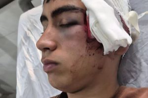 دادستان بم پرونده مصدومیت دانش‌آموز دهبکری را بررسی می‌کند